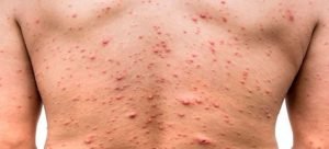 Taxi termina atrapado en montículo de tierra