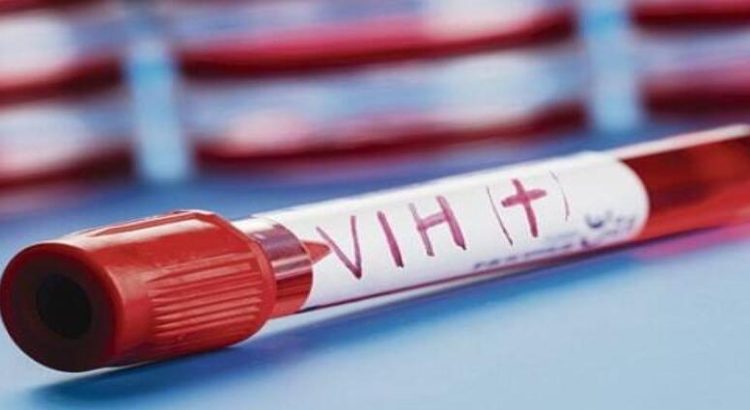 Al alza casos de VIH en el estado de Sinaloa