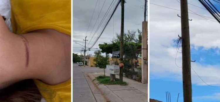 Una joven resulta lesionada por unos cables colgados en la calle