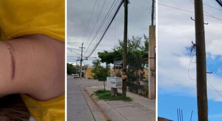 Una joven resulta lesionada por unos cables colgados en la calle