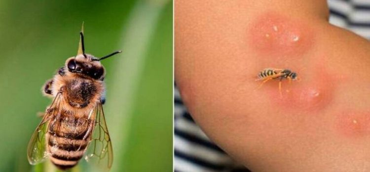 Muere niño de 6 años por picaduras de abejas